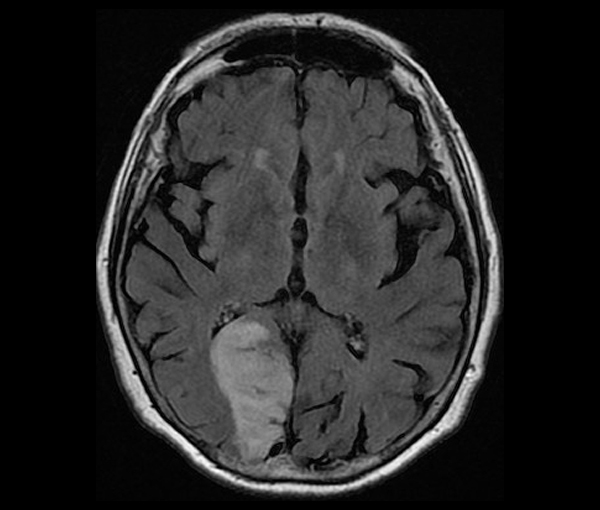 Imagerie du cerveau et de la moelle épinière l Institut de radiologie Paris