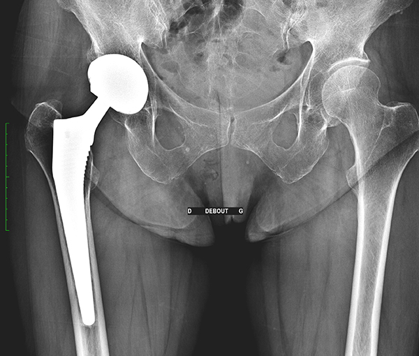 Radiographie - examen d'imagerie l Institut de radiologie de Paris
