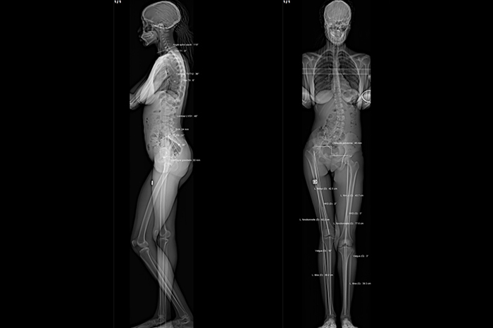 Imagerie des os et articulations l Institut de radiologie de Paris