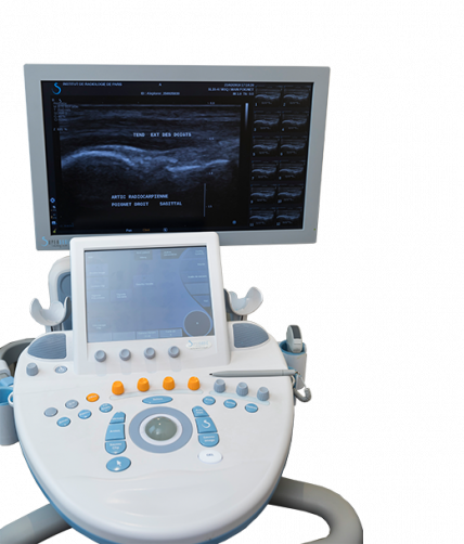 Echographie Doppler - examen d'imagerie l Institut de radiologie de Paris