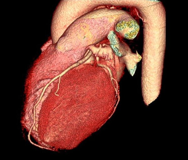 Scanner - examen d'imagerie l Institut de radiologie de Paris