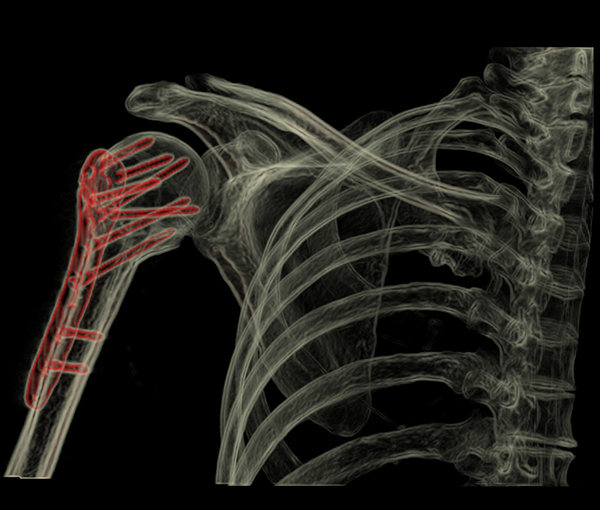 Scanner - examen d'imagerie l Institut de radiologie de Paris