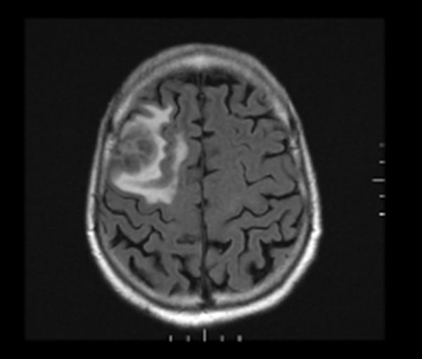 Imagerie du cerveau et de la moelle épinière l Institut de radiologie Paris