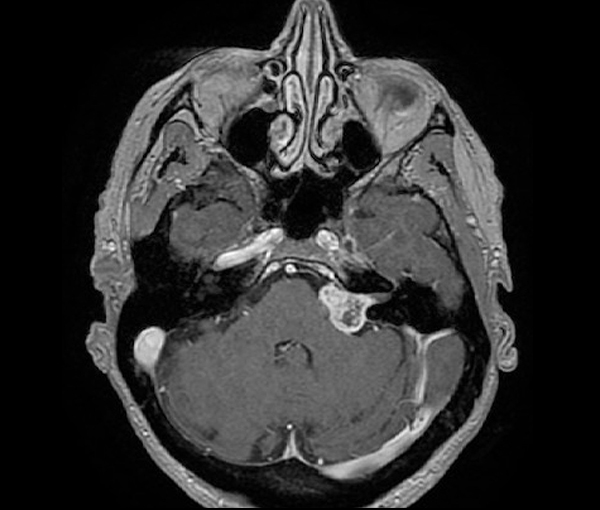 Imagerie du cerveau et de la moelle épinière l Institut de radiologie Paris