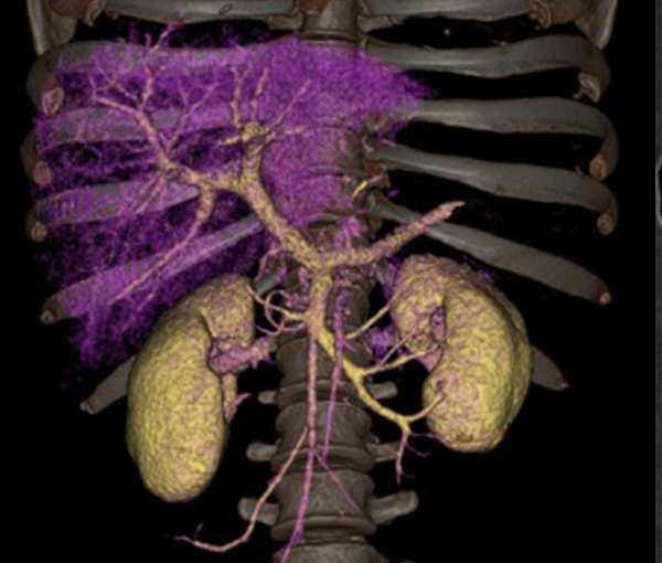 Imagerie de l'appareil digestif l Institut de radiologie de Paris