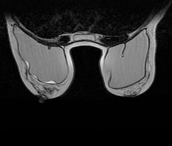 Imagerie du sein - imagerie de la femme l Institut de radiologie de Paris