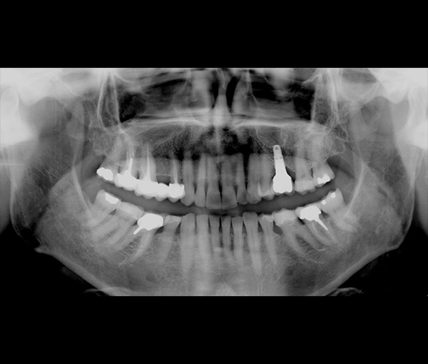 Imagerie dentaire, imagerie des dents l Institut de radiologie de Paris