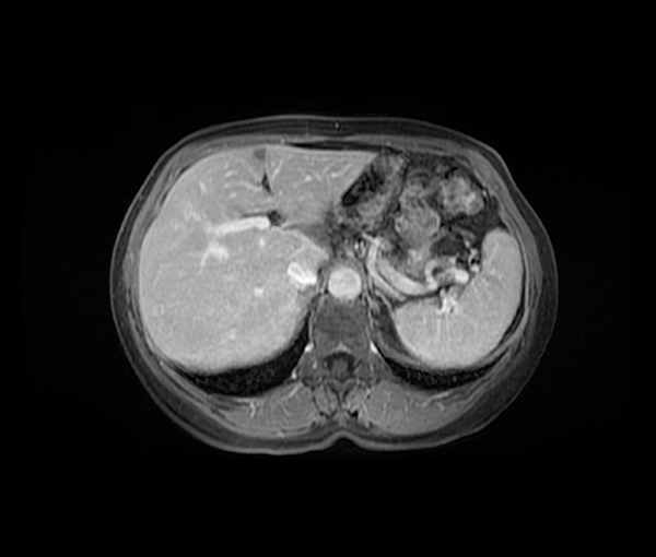 Imagerie de l'appareil digestif l Institut de radiologie de Paris