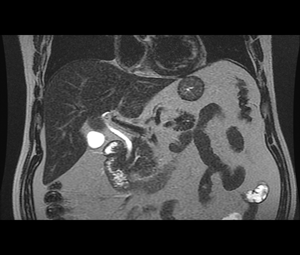 Imagerie de l'appareil digestif l Institut de radiologie de Paris