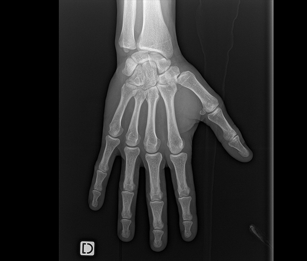 Radiographie - examen d'imagerie l Institut de radiologie de Paris