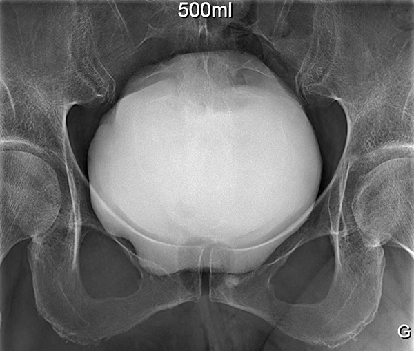 Radiographie - examen d'imagerie l Institut de radiologie de Paris