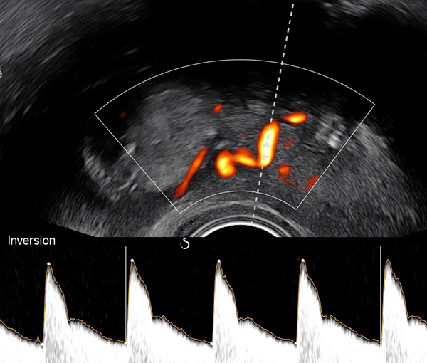 Echographie Doppler - examen d'imagerie l Institut de radiologie de Paris