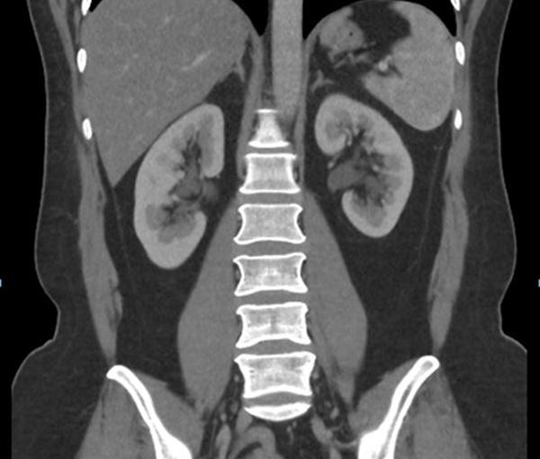 Scanner - examen d'imagerie l Institut de radiologie de Paris