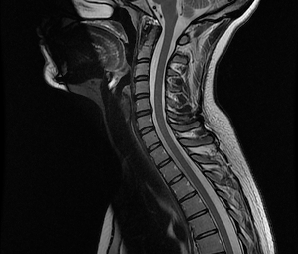 IRM - examen d'imagerie à Paris l Institut de radiologie de Paris