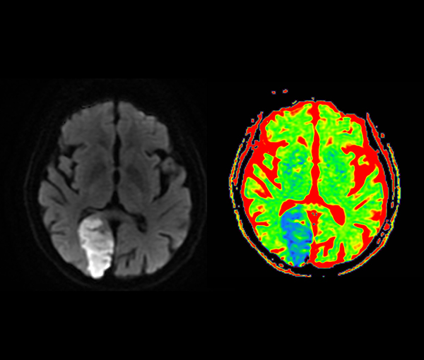 IRM - examen d'imagerie à Paris l Institut de radiologie de Paris