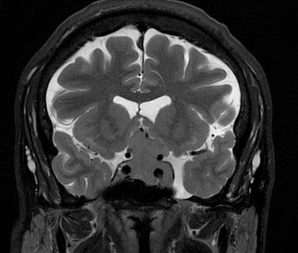 IRM - examen d'imagerie à Paris l Institut de radiologie de Paris