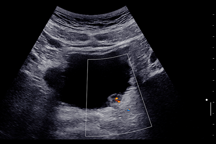 Imagerie rein, vessie et prostate l Institut de radiologie de Paris