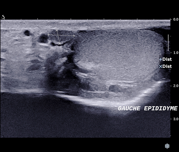 Imagerie organes génitaux masculins l Institut de radiologie de Paris