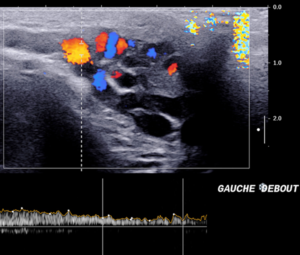 Imagerie organes génitaux masculins l Institut de radiologie de Paris