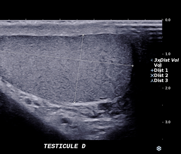 Imagerie organes génitaux masculins l Institut de radiologie de Paris