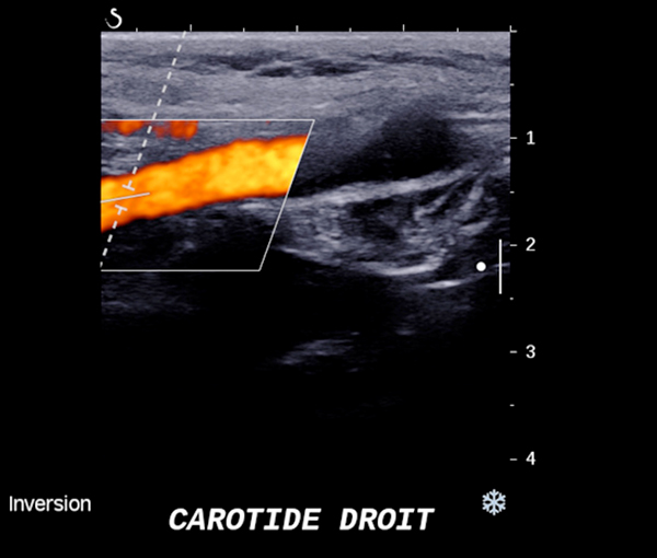 Imagerie vaisseaux et coeur l Institut de radiologie de Paris