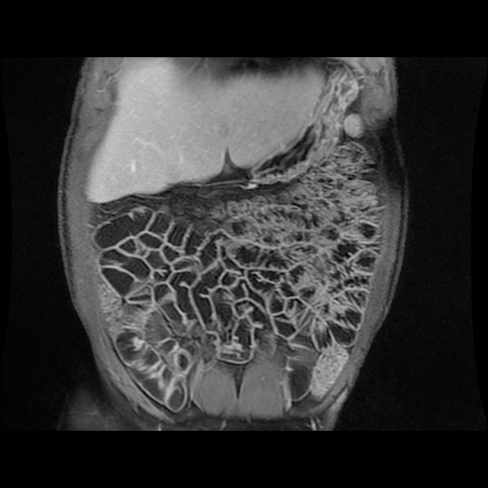 IRM - examen d'imagerie à Paris l Institut de radiologie de Paris