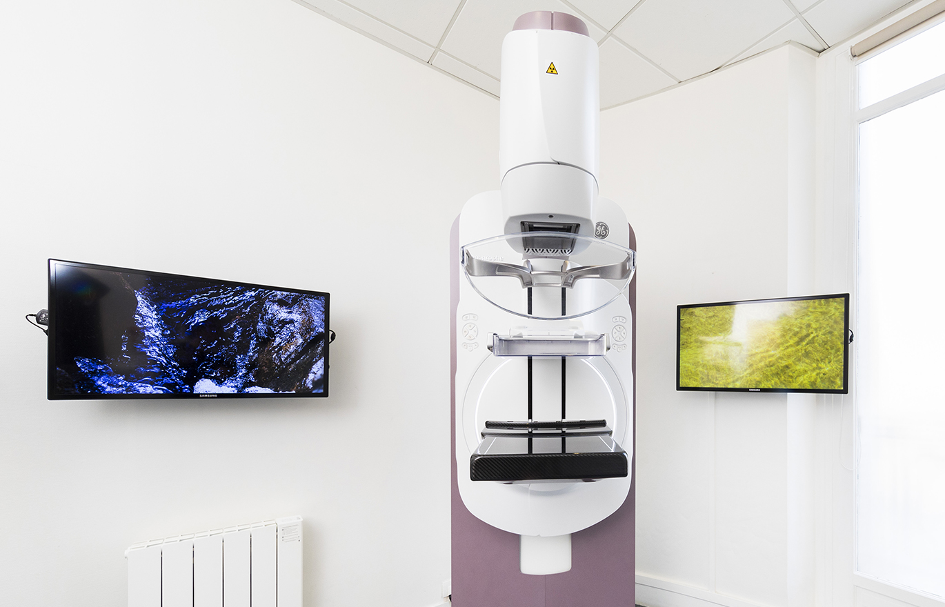 Galactographie - imagerie de la femme l Institut de radiologie de Paris