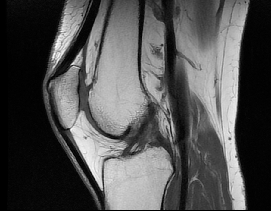 Imagerie des os et articulations l Institut de radiologie de Paris