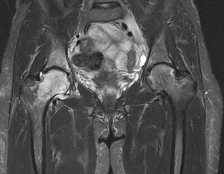 Imagerie des os et articulations l Institut de radiologie de Paris