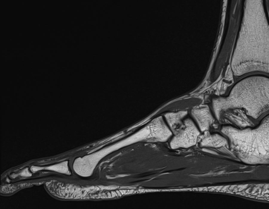 Imagerie des os et articulations l Institut de radiologie de Paris