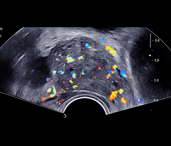 Imagerie rein, vessie et prostate l Institut de radiologie de Paris