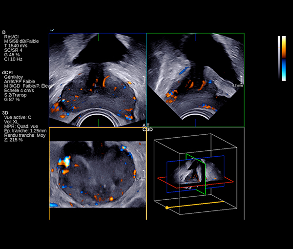 Imagerie rein, vessie et prostate l Institut de radiologie de Paris