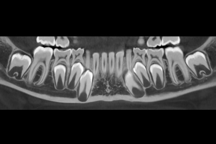 Imagerie dentaire, imagerie des dents l Institut de radiologie de Paris