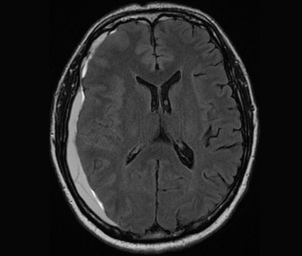 Imagerie du cerveau et de la moelle épinière l Institut de radiologie Paris
