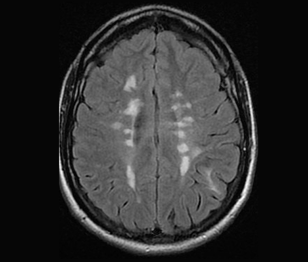 Imagerie du cerveau et de la moelle épinière l Institut de radiologie Paris