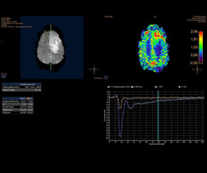 Nouvelle IRM 3T l Institut de radiologie de Paris