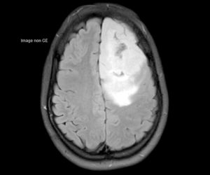 Nouvelle IRM 3T l Institut de radiologie de Paris