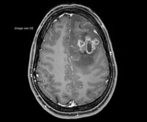 Nouvelle IRM 3T l Institut de radiologie de Paris