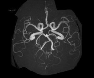 Nouvelle IRM 3T l Institut de radiologie de Paris