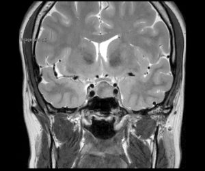 Nouvelle IRM 3T l Institut de radiologie de Paris