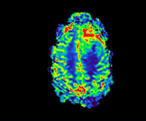 Nouvelle IRM 3T l Institut de radiologie de Paris