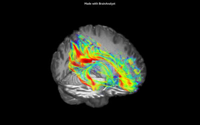 Nouvelle IRM 3T l Institut de radiologie de Paris