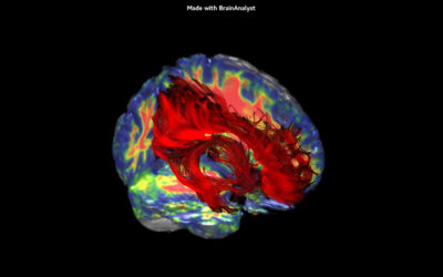 Nouvelle IRM 3T l Institut de radiologie de Paris