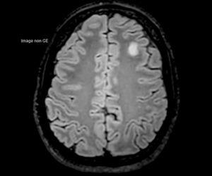 Nouvelle IRM 3T l Institut de radiologie de Paris