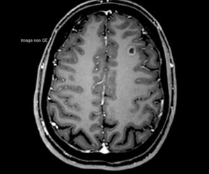 Nouvelle IRM 3T l Institut de radiologie de Paris