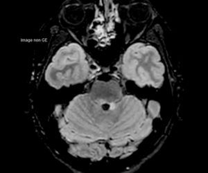 Nouvelle IRM 3T l Institut de radiologie de Paris