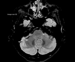 Nouvelle IRM 3T l Institut de radiologie de Paris